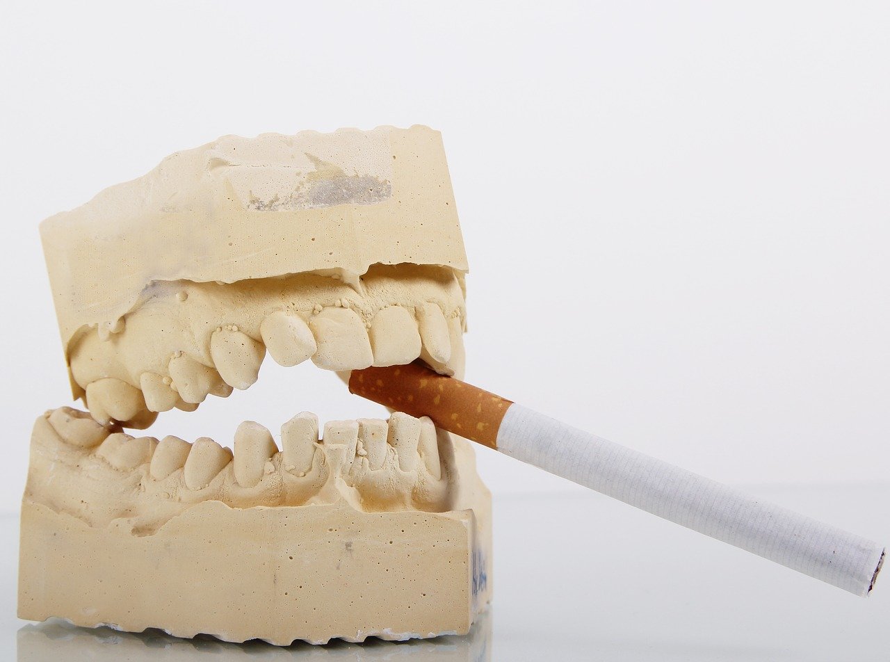 elfbar nachfüll pod läuft aus Santé bucco-dentaire : vapoter pourrait entraîner des caries