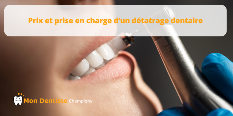 Prix et remboursement détartrage dentaire