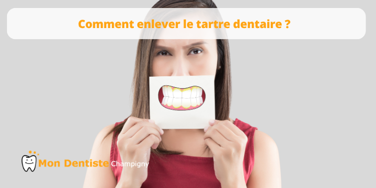 Comment enlever le tartre sur les dents