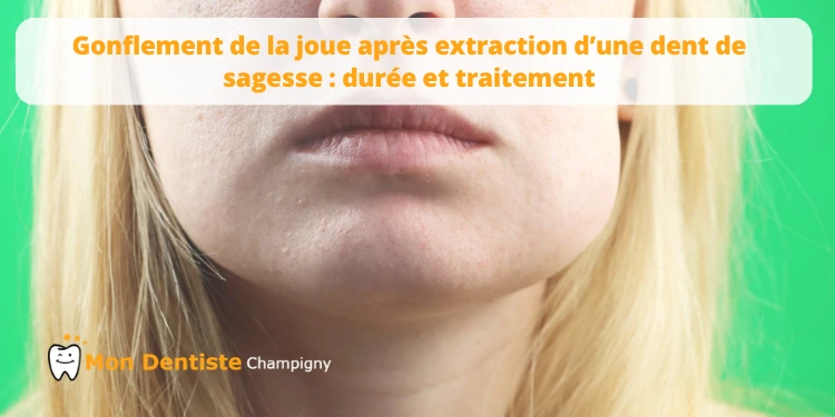 Joue gonflée après extraction dentaire combien de temps